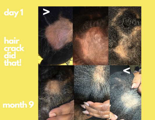 Hair Crack- Revitalize your scalp, follicles & tips to their healthiest state,