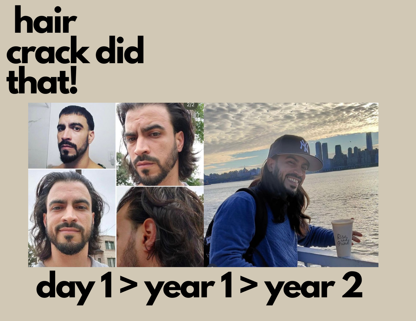 Hair Crack- Revitalize your scalp, grow follicles & tips to their healthiest state,